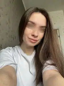 контурная пластика губ